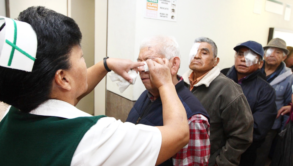 ¡Alarmante! Yucatán registra 40 casos de conjuntivitis al día: Secretaría de Salud