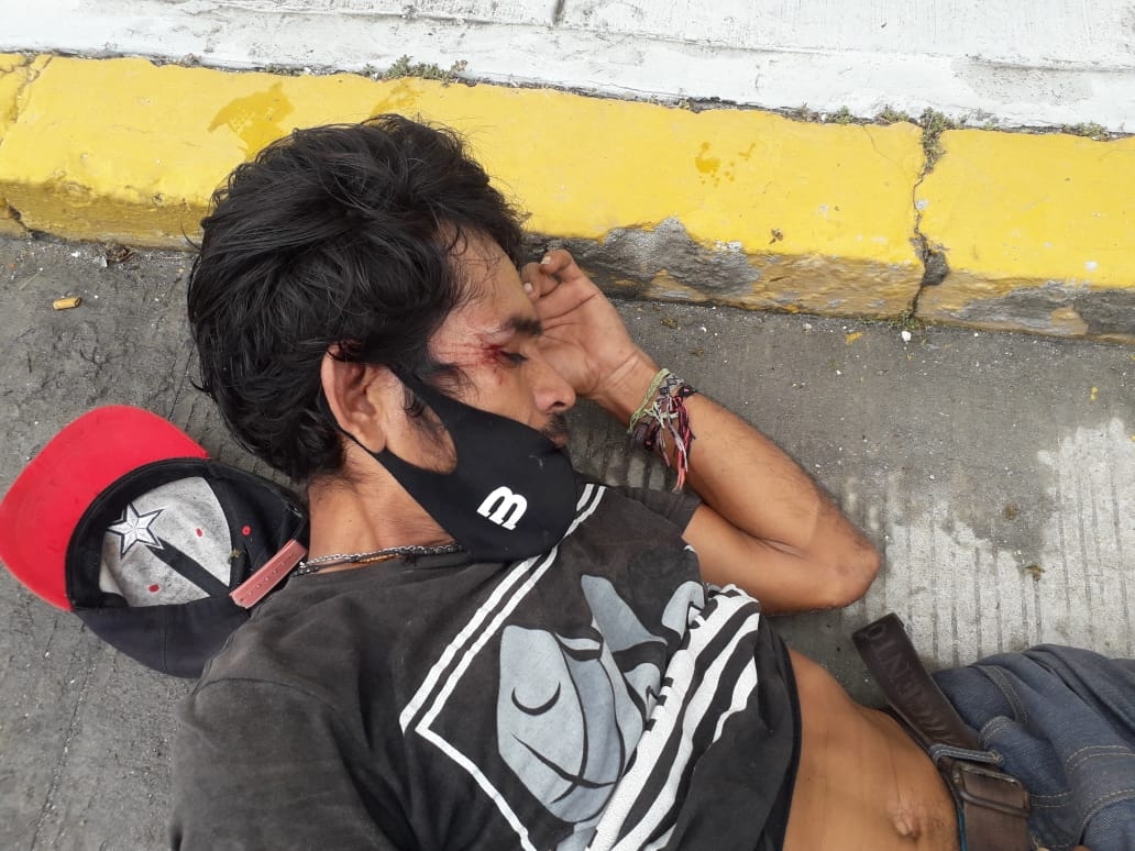 Golpean con tubo a presunto ladrón en Ciudad del Carmen