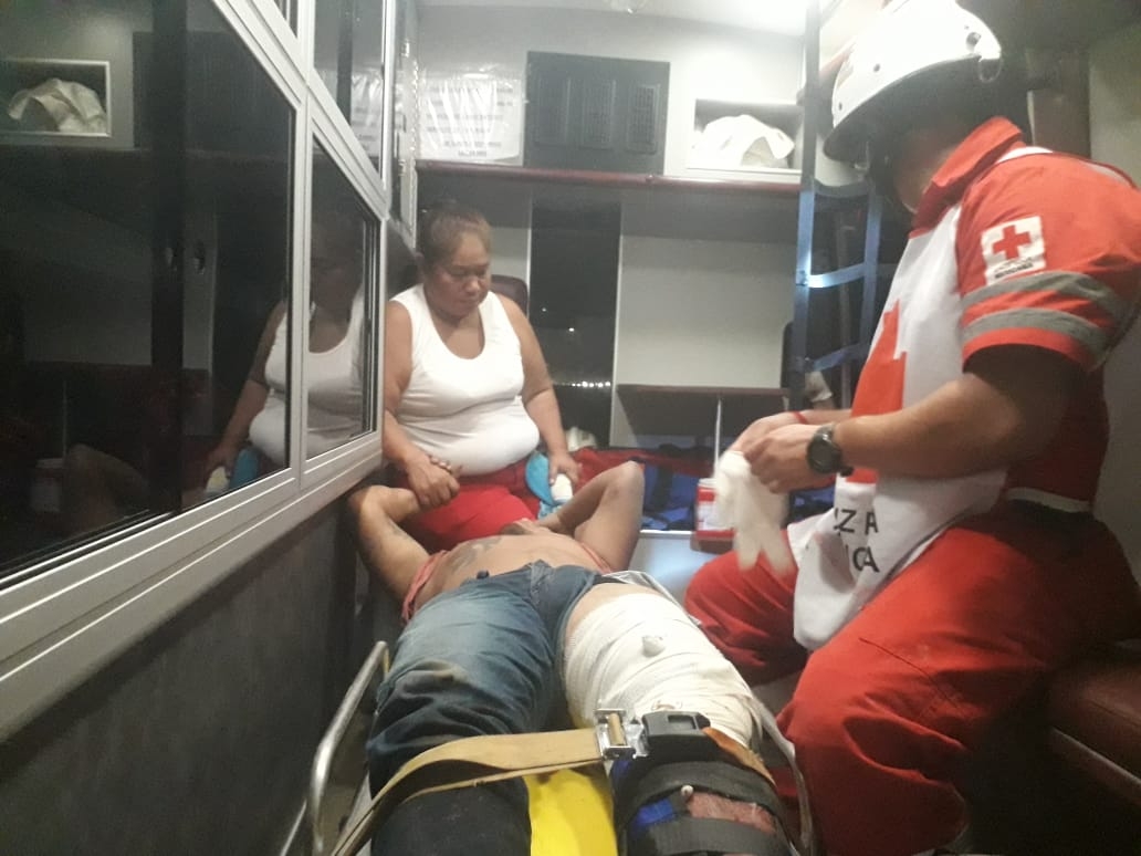 Ebrio se fractura la pierna por estrellarse contra un muro en Ciudad del Carmen