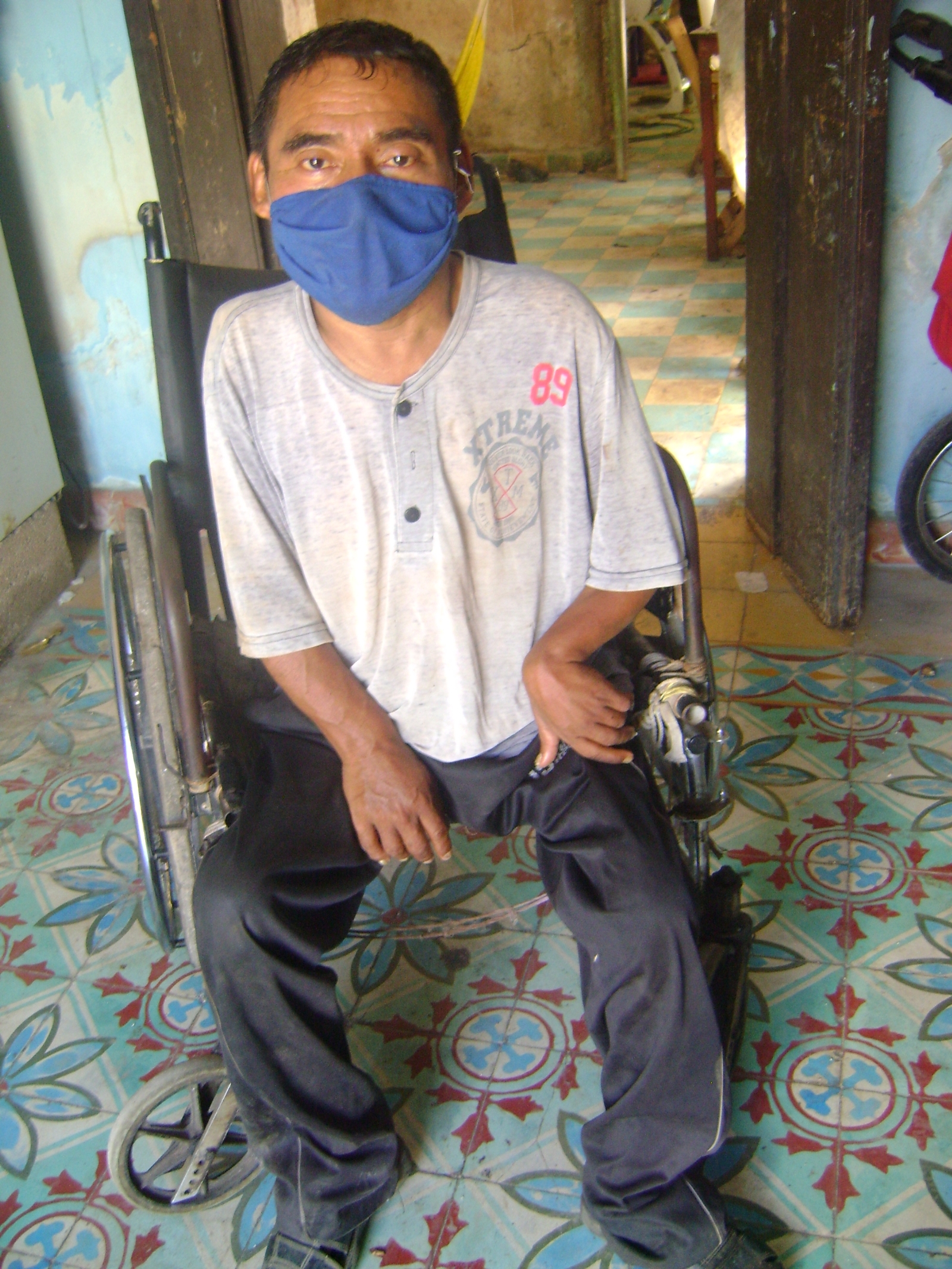 COVID-19 deja sin empleo a persona con discapacidad en Peto