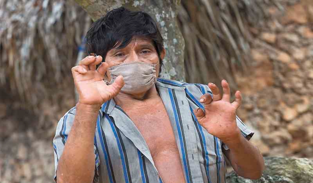 Casos de sordera en Yucatán: ¿Cómo prevenir esta enfermedad?, esto dice la OMS