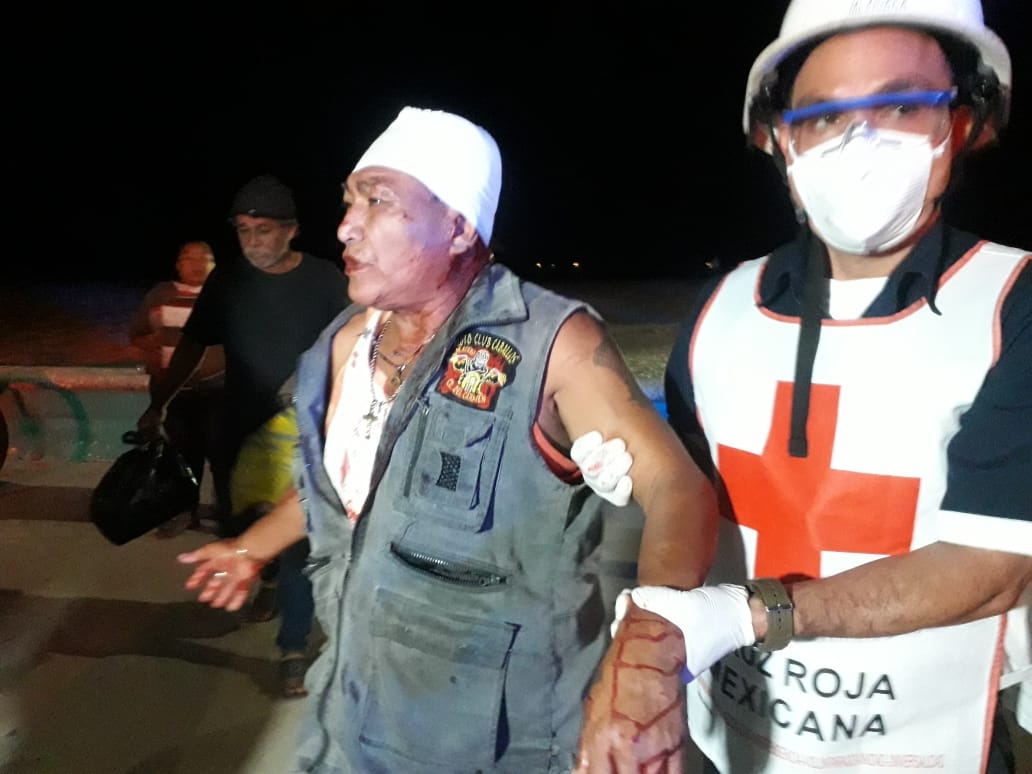 Por negar un trago, hombre termina con herida en la cabeza en Ciudad del Carmen