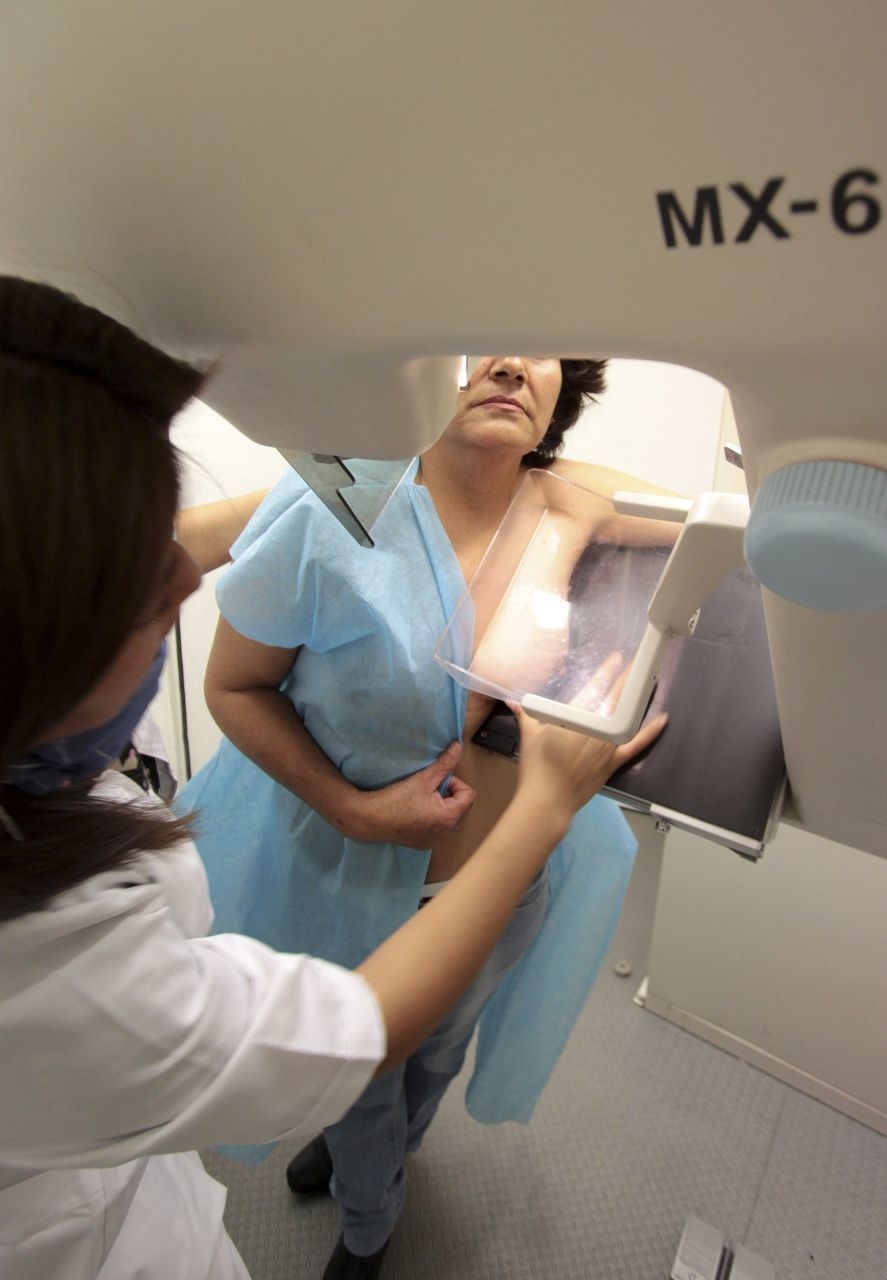 Aumentan 117% los casos de cáncer de mama y cervicouterino en Quintana Roo