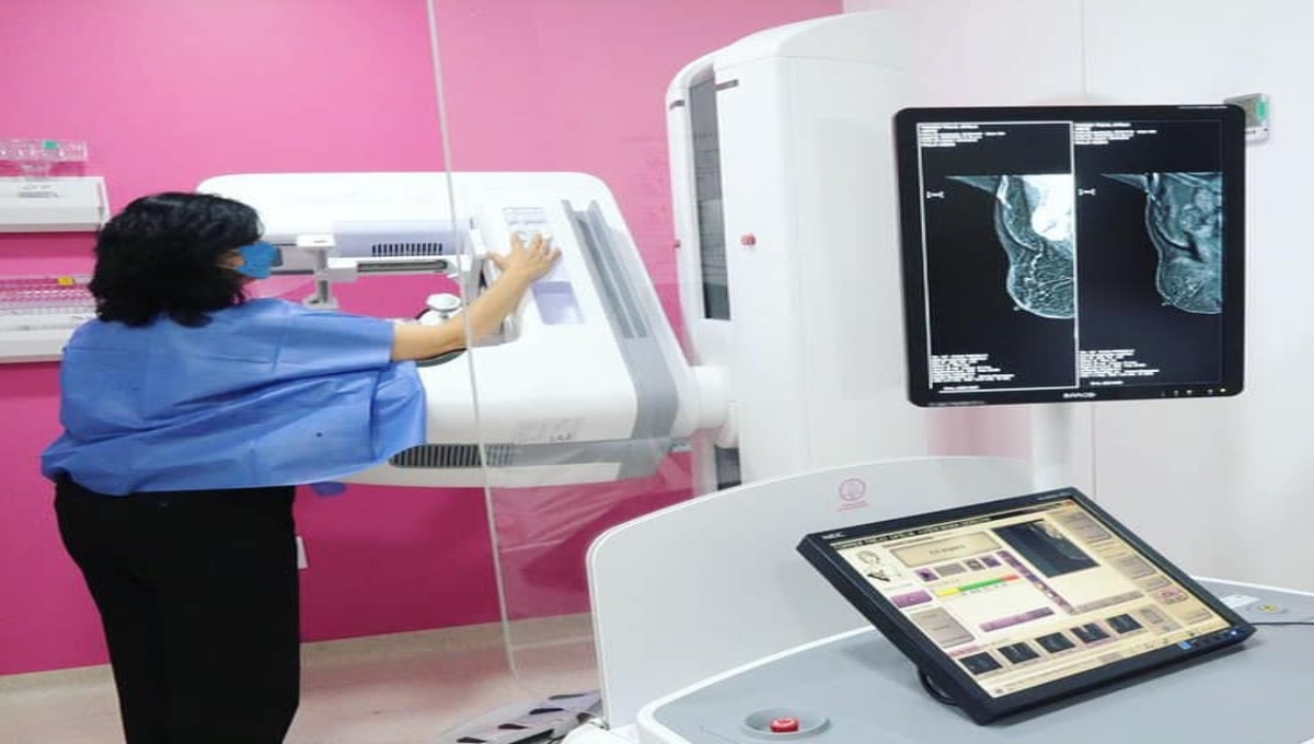 Fucam ofrece mastografías gratis para la detección oportuna del cáncer de mama en la CDMX
