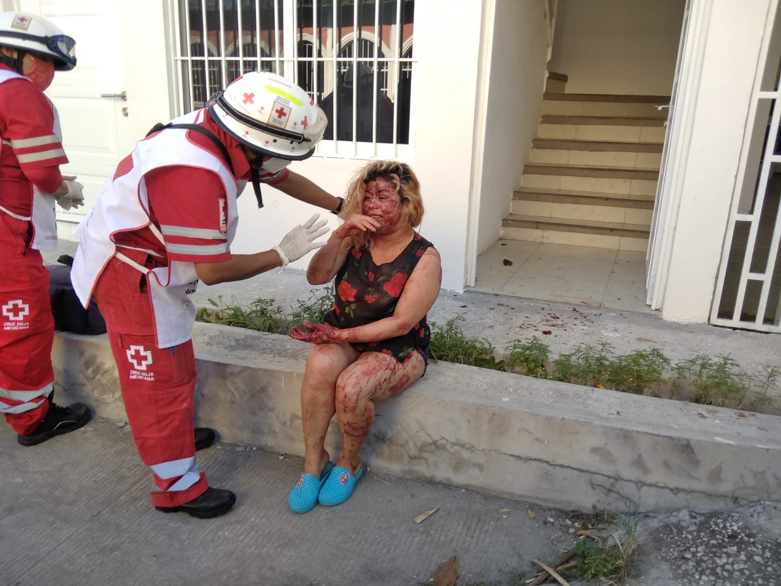 Mujer termina ensangrentada tras violenta riña con su pareja en Ciudad del Carmen