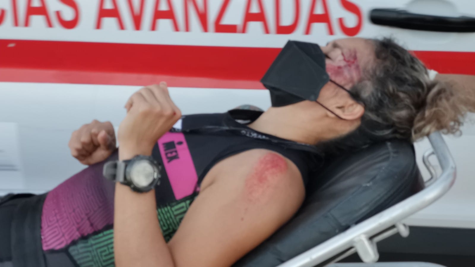 Choque entre ciclistas deja a dos mujeres con lesiones y fracturas en Ciudad del Carmen