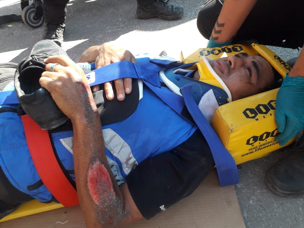 Repartidor de pizza termina con graves lesiones tras impacto en Ciudad del Carmen