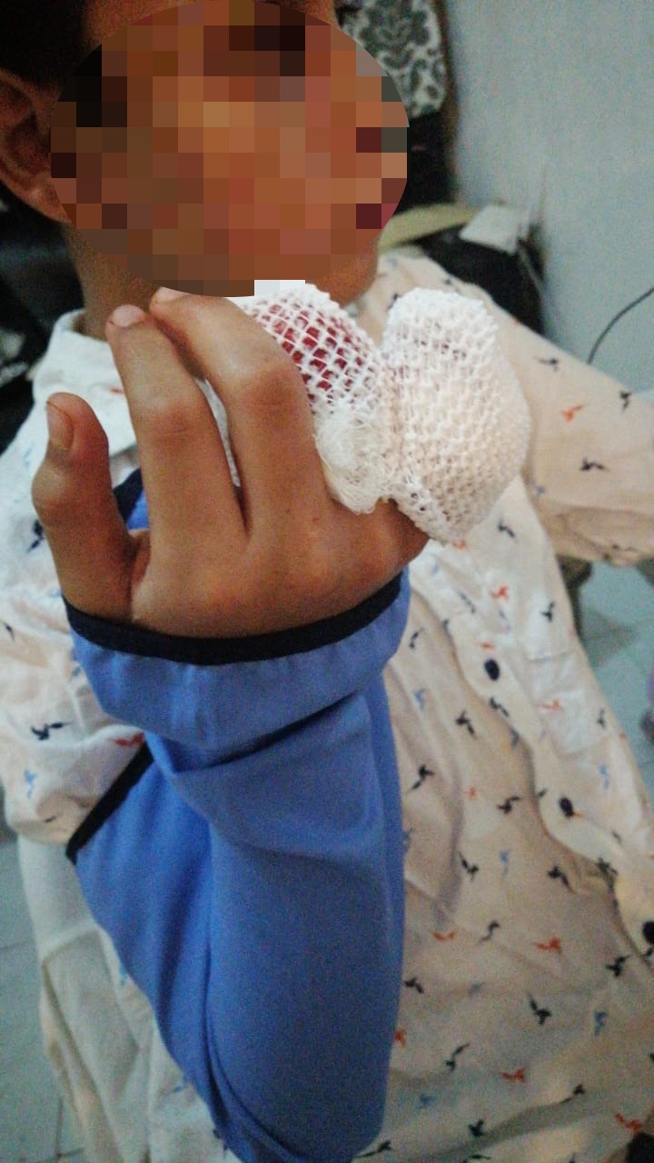 Menor de 11 años pierde dos dedos por colapso de juego infantil en Chetumal