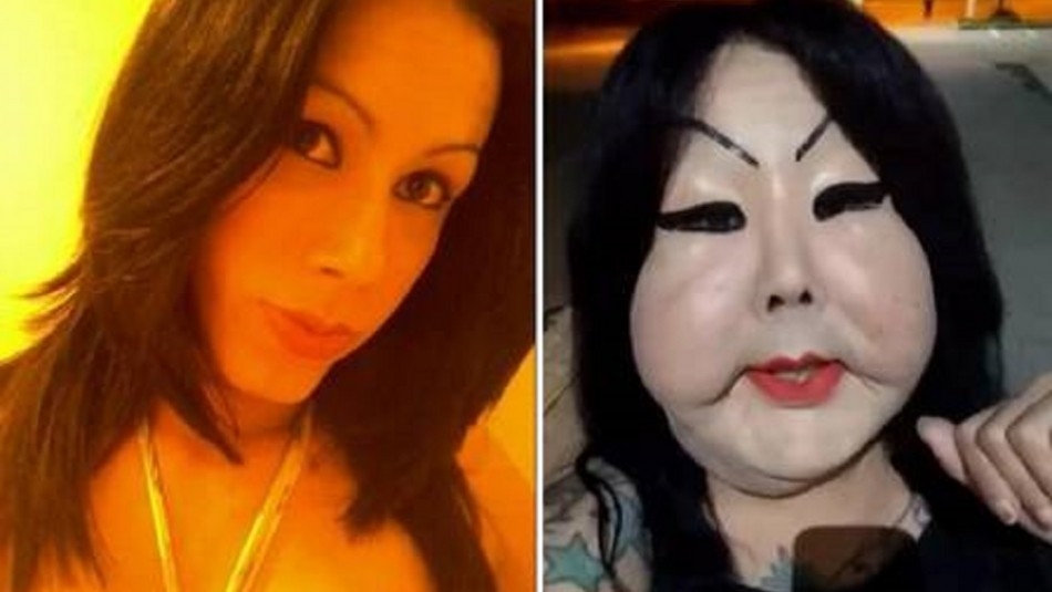 Mujer transgénero se deforma la cara con silicona industrial: VIDEO