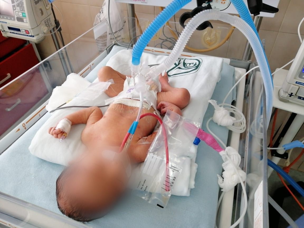 La Tasa Nacional de Incidencia en recién nacidos portadores del virus es de 90.88 por cada 100 mil recién nacidos vivos