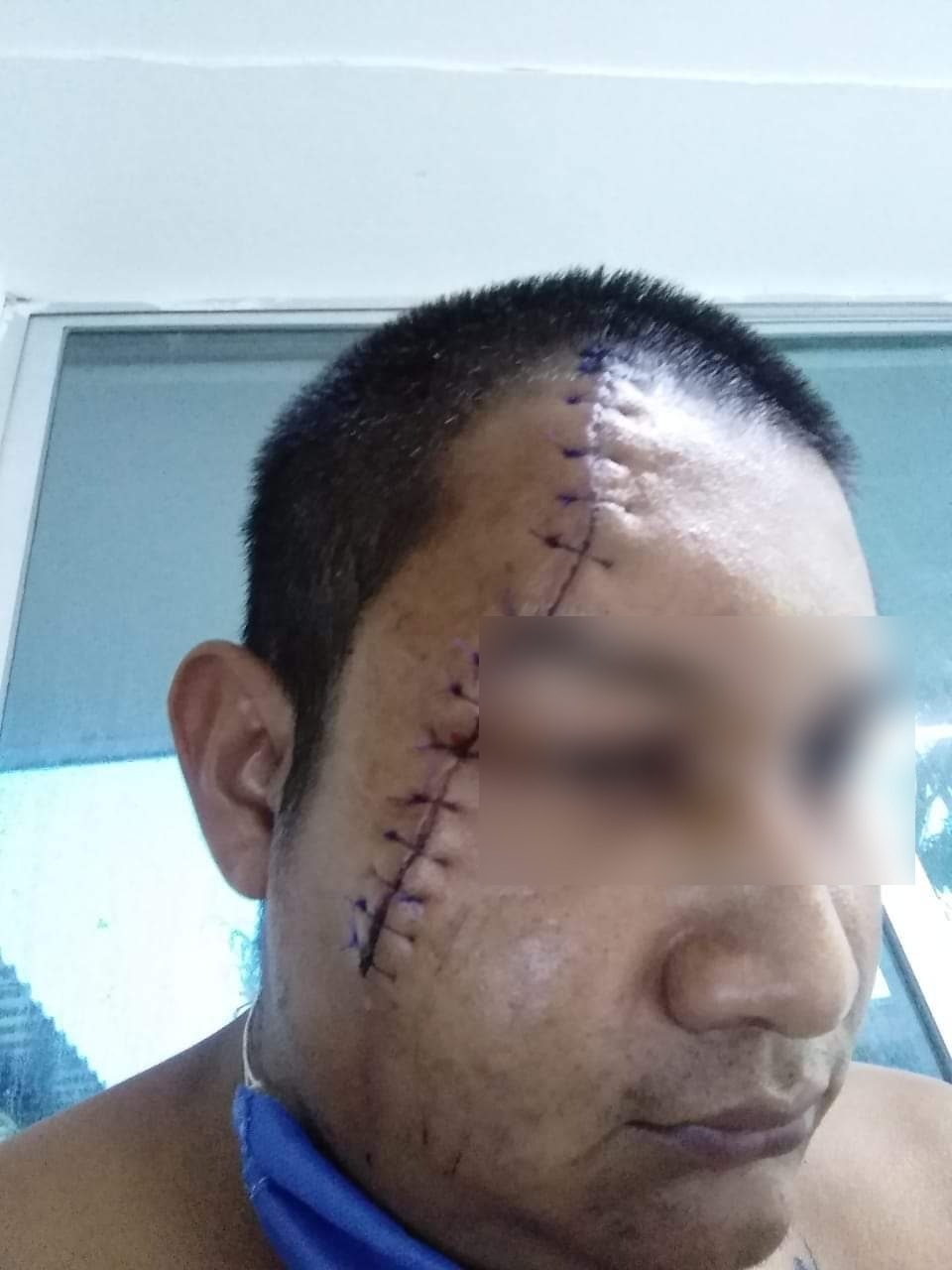 Denuncian caso de brutalidad policiaca en colonia Proterritorio de Chetumal