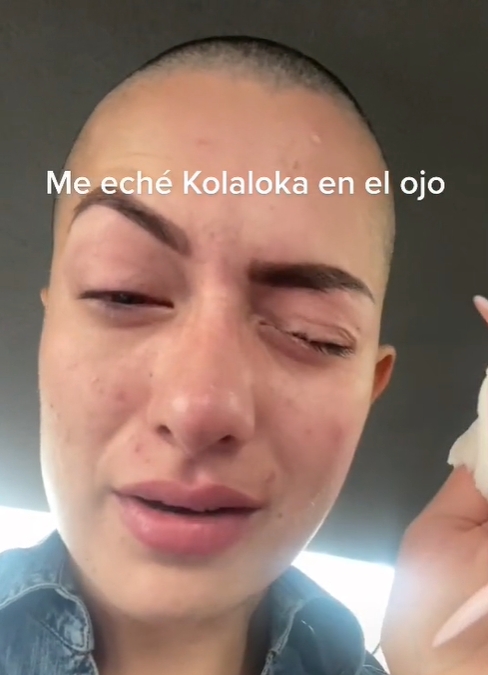 Confunde Kola Loka con sus gotas para los ojos y para en el hospital: VIDEO