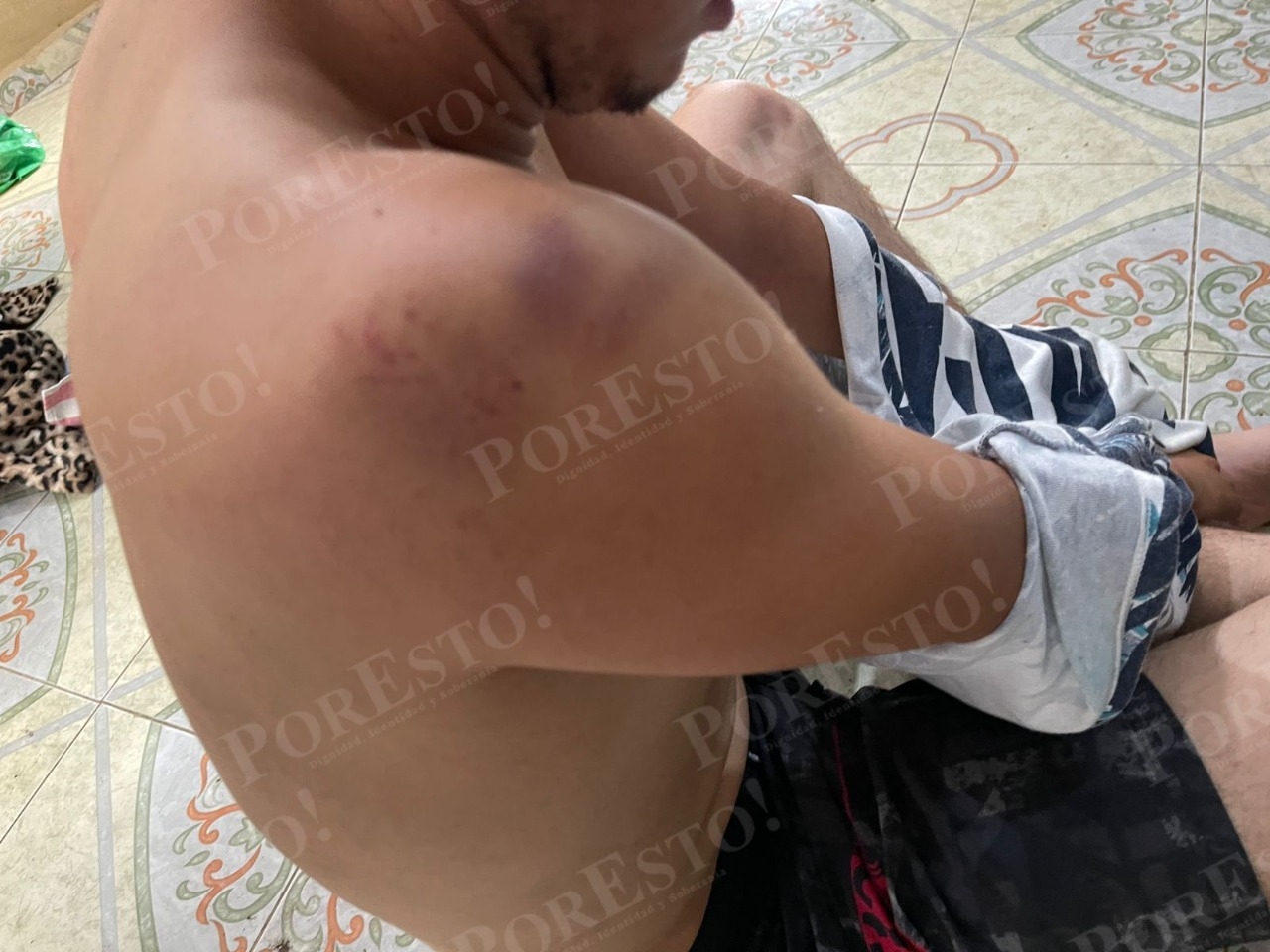 Filtran fotos de José Eduardo después de haber sido agredido por policías de Mérida: FOTOS