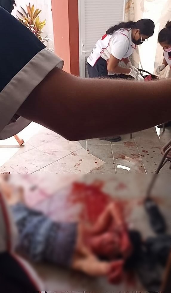 Mujer intenta suicidarse al cortarse las venas en Cozumel