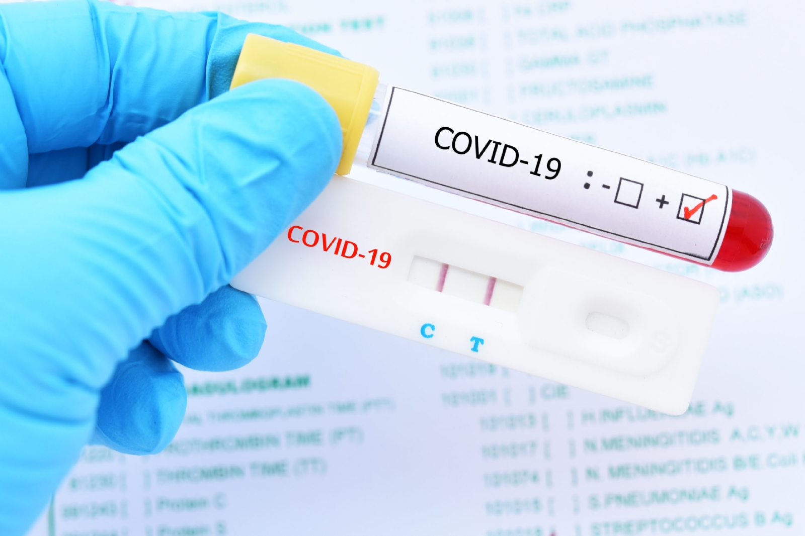 Crean Innovadora prueba PCR para detectar COVID-19 en niños