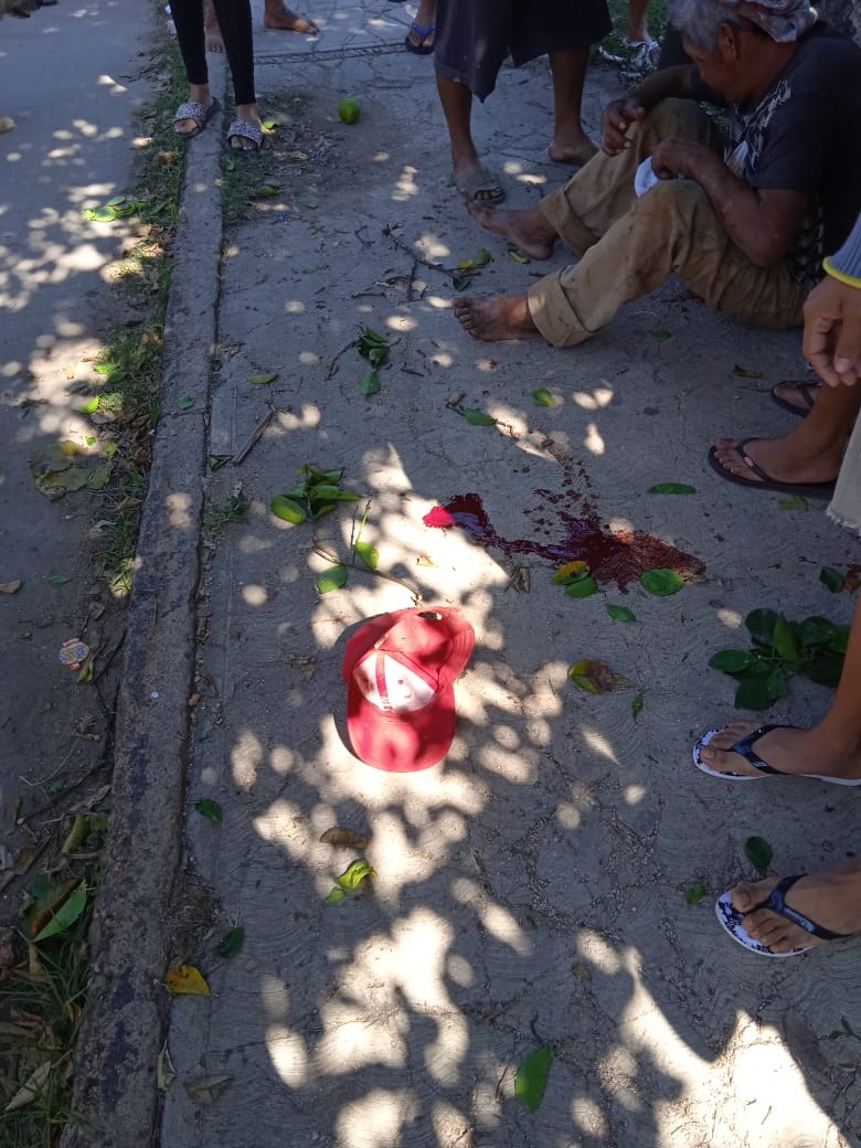 Muere abuelito en hospital comunitario tras caerse de una barda en Calkiní, Campeche