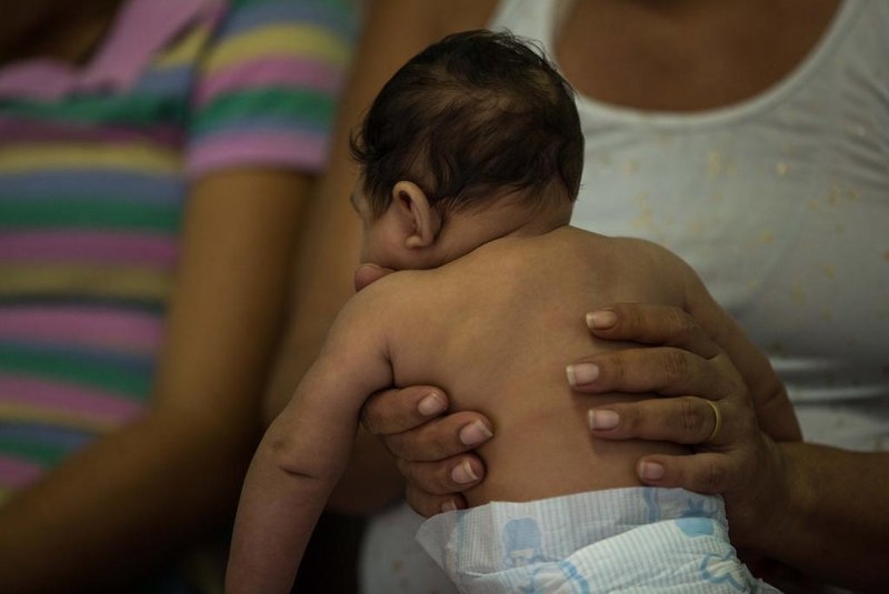 Microcefalia, enfermedad congénita que afecta a 1 de cada 4 bebés en Yucatán