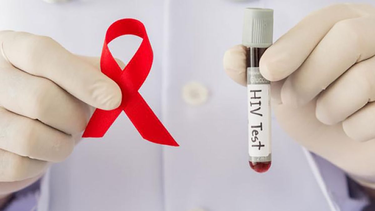 Descubren nueva variante del VIH que podría ser más agresiva