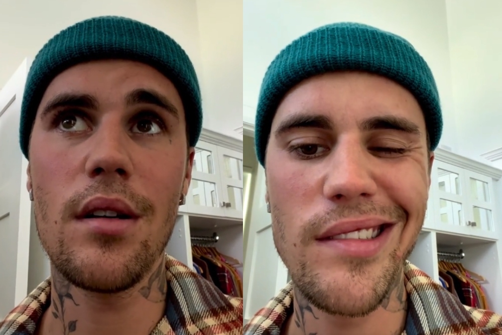 Justin Bieber mostró a sus fans la zona de la parálisis facial que sufrió y que lo obliga a cancelar una serie de conciertos ya pactados