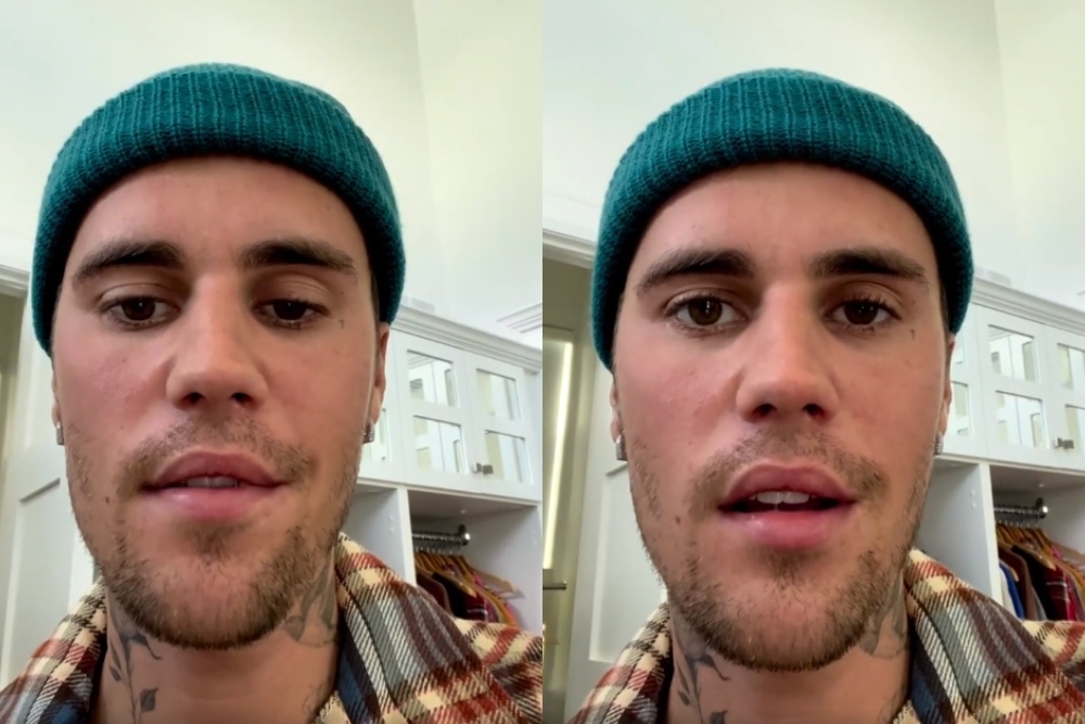 En el video que subió a Instagram, se ven las afectaciones de la parálisis facial que sufrió Justin Bieber, causado por el Síndrome de Ramsay Hunt