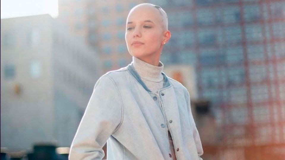 Camila Solórzano fue diagnosticada a los 3 años con alopecia areata, una enfermedad que se manifiesta con la caída del cabello
