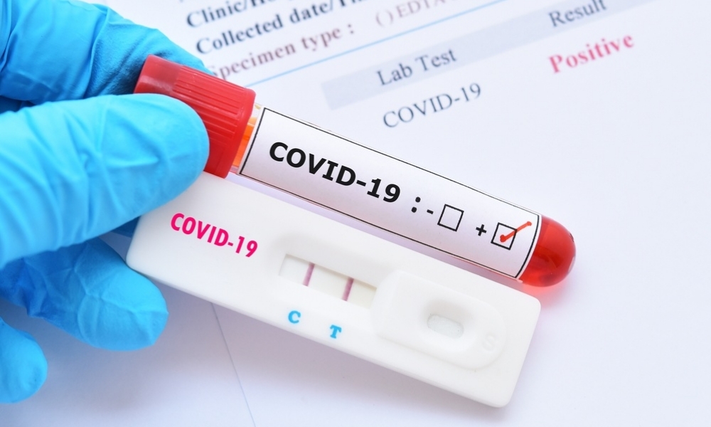 ¿Cuánto costarán las pruebas nasales contra COVID-19 en Walmart y Bodega Aurrera?