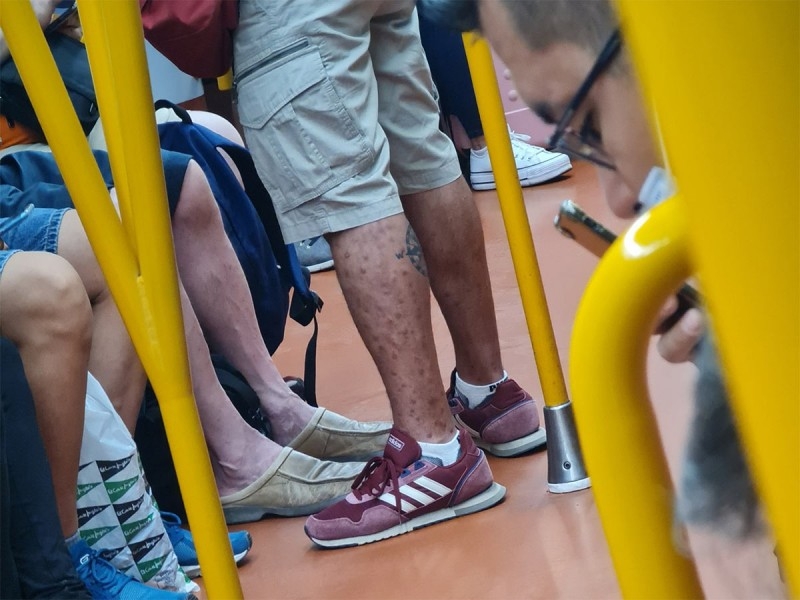 Hombre es captado con viruela del mono mientras viaja en el Metro de Madrid