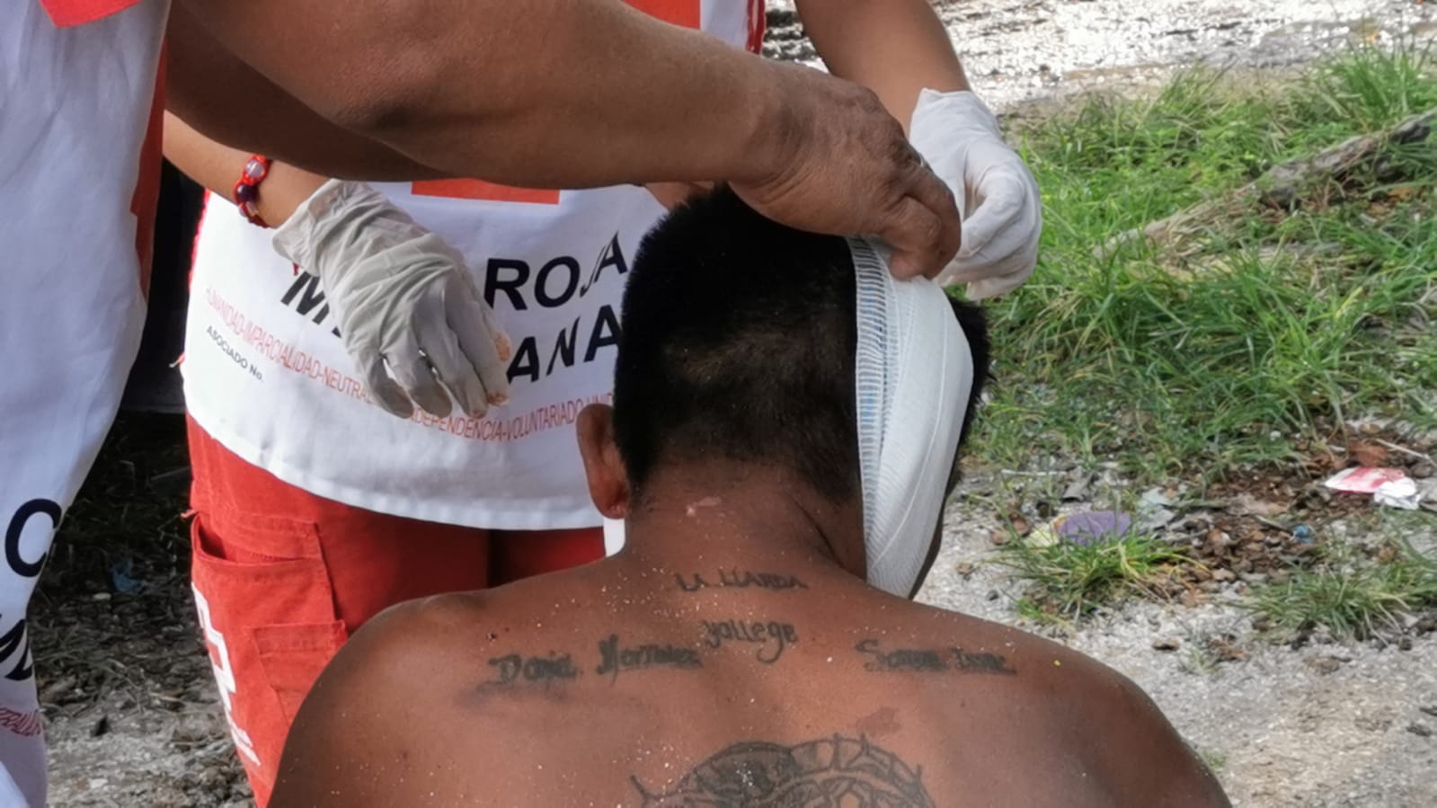 En Yucatán, se registraron 991 personas lesionadas por quemaduras durante el 2022
