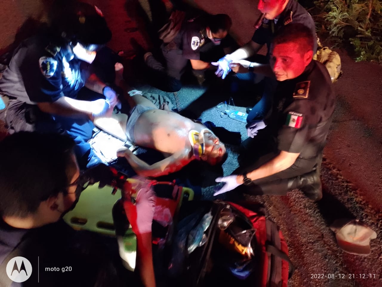 Vehículo embiste a motociclista y lo deja gravemente herido en Mérida