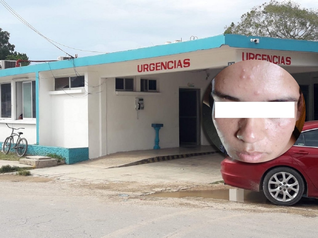 Presunto caso de viruela del mono en Carrillo Puerto causa alerta entre los vecinos