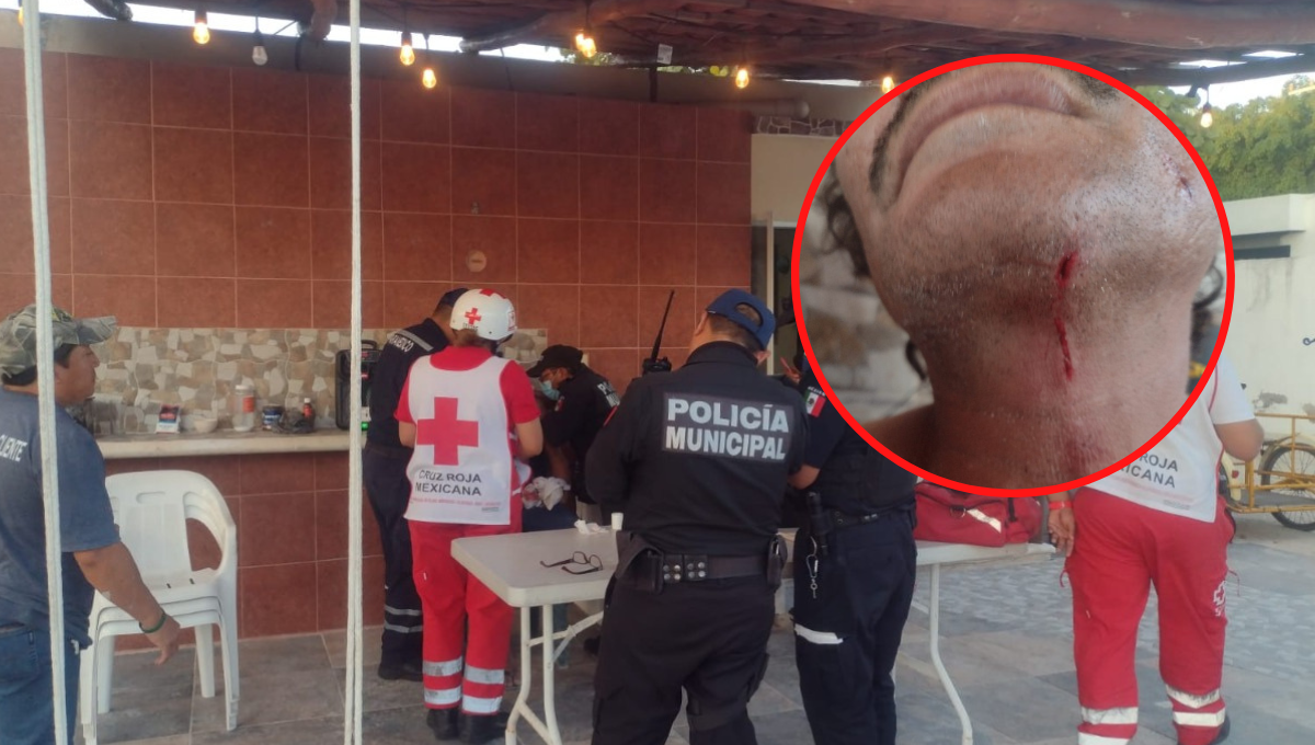 Hombre resulta con heridas graves tras accidente de trabajo en Chicxulub, Progreso