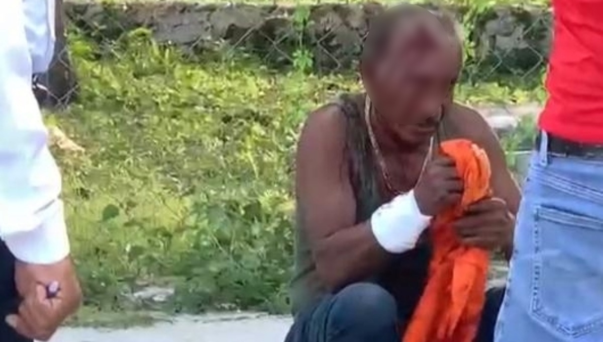 Hombre machetea a su expareja por 'infiel' en Champotón