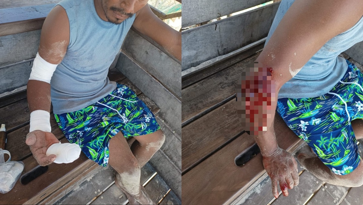 Pitbull ataca a un bañista en Playa del Carmen