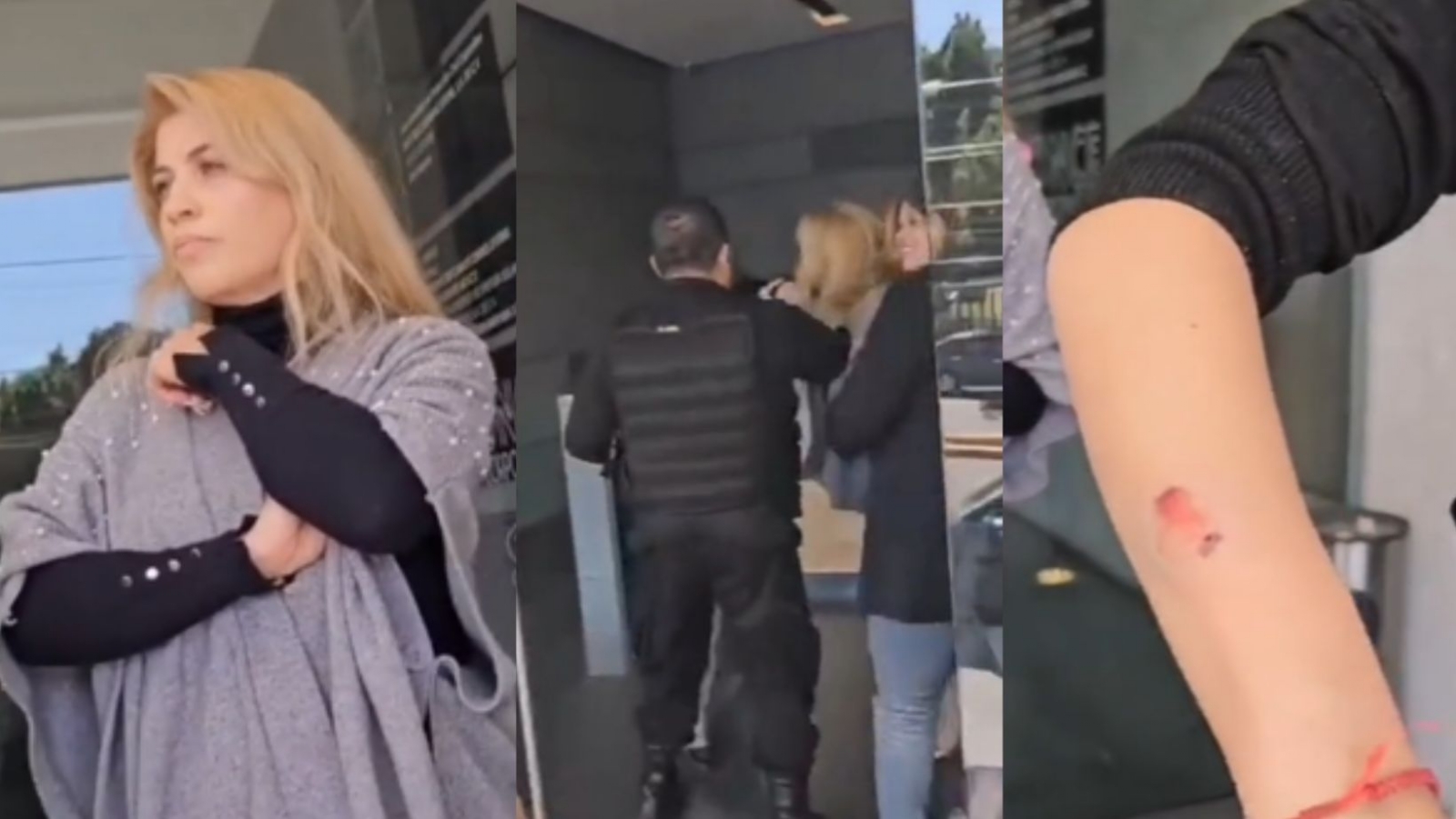 'Lady mordidas' ataca a una empleada en spa de Edomex