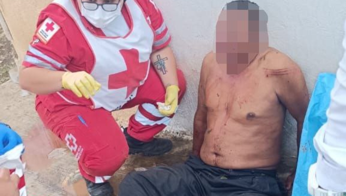 El hombre herido fue trasladado a un hospital de Campeche