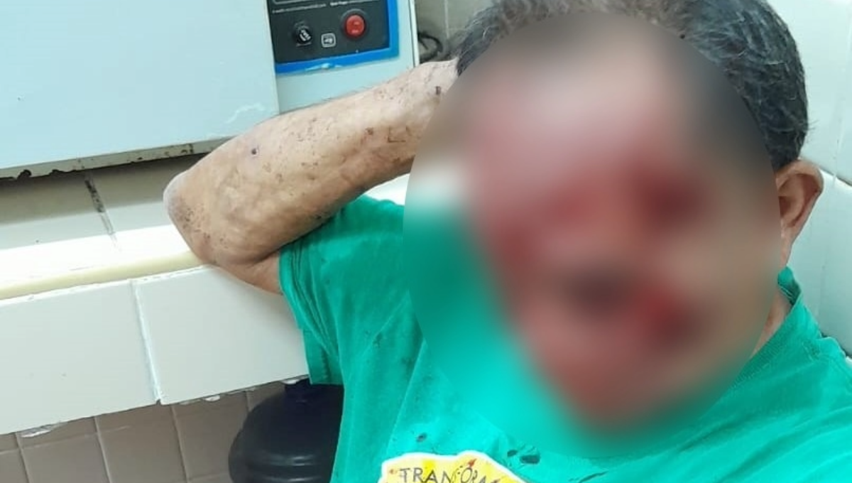 Yucatán: Hombre resulta herido tras explotarle una llanta en la cara en Suma Hidalgo