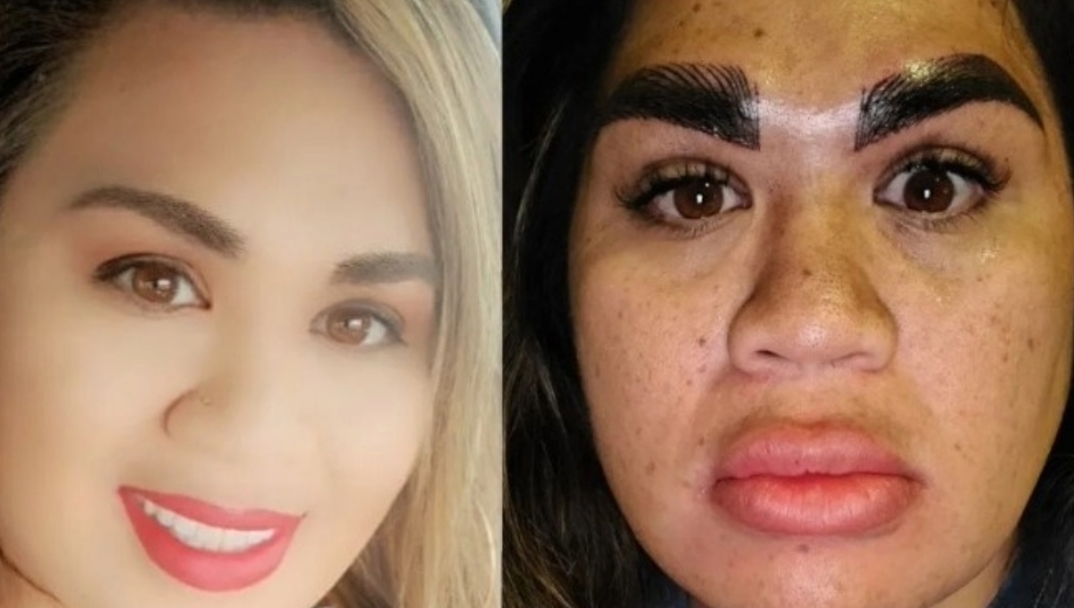 Mujer paga siete mil pesos en un diseño de cejas y le arruinan el rostro en Texas