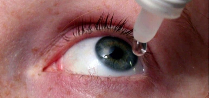 La enfermedad consiste en una inflamación de la membrana que cubre parte de los ojos