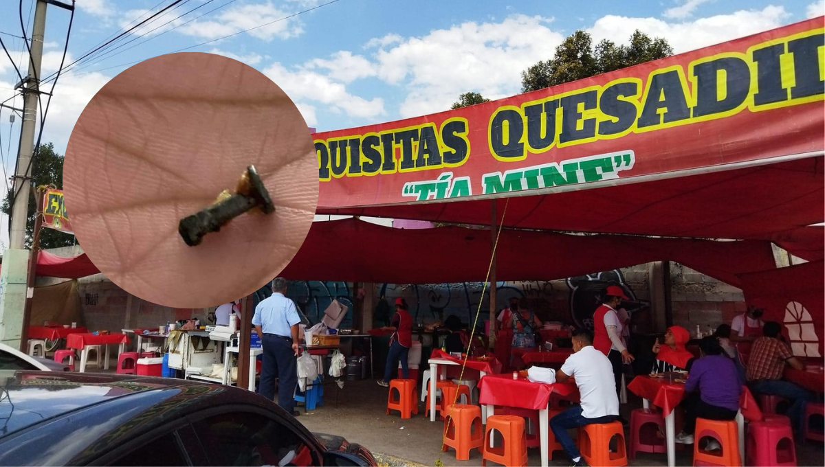 Mujer queda chimuela por comer una quesadilla en Hidalgo; tenía un clavo adentro
