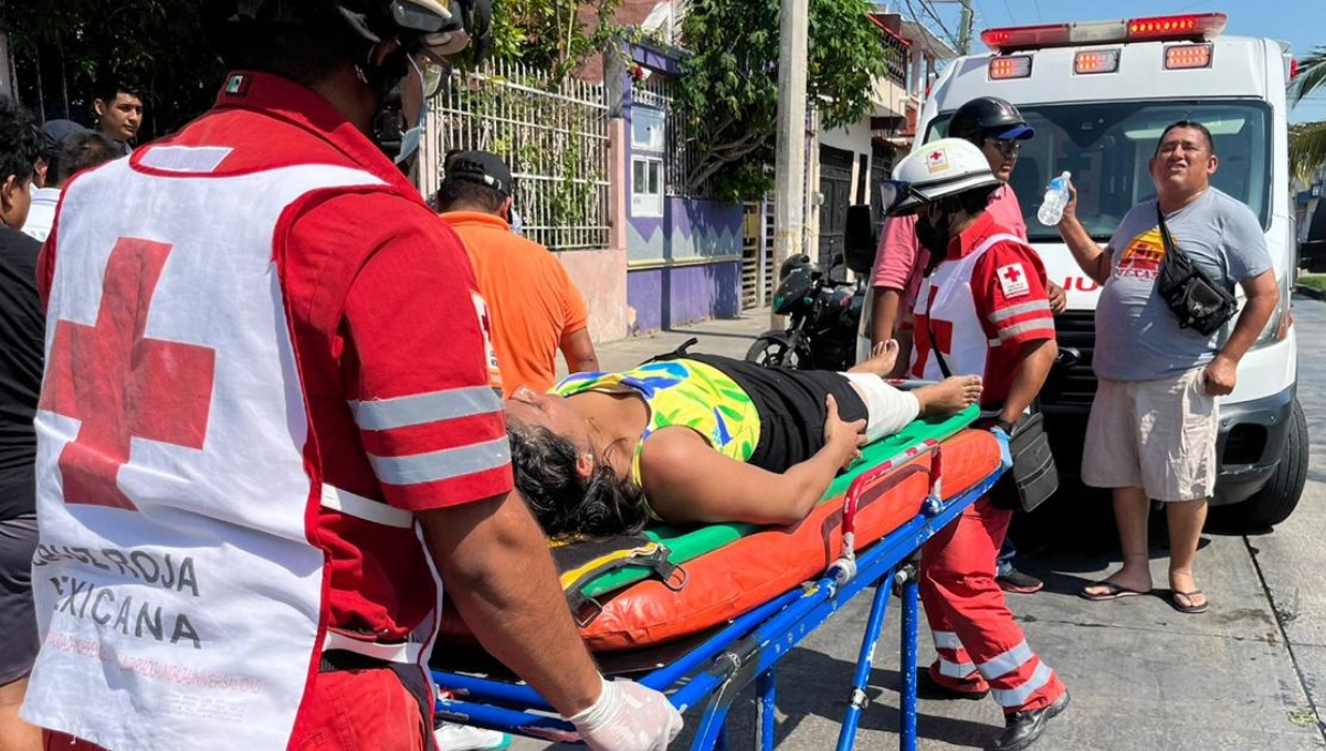 Motociclista derrapa en Ciudad del Carmen y termina con fractura en la pierna