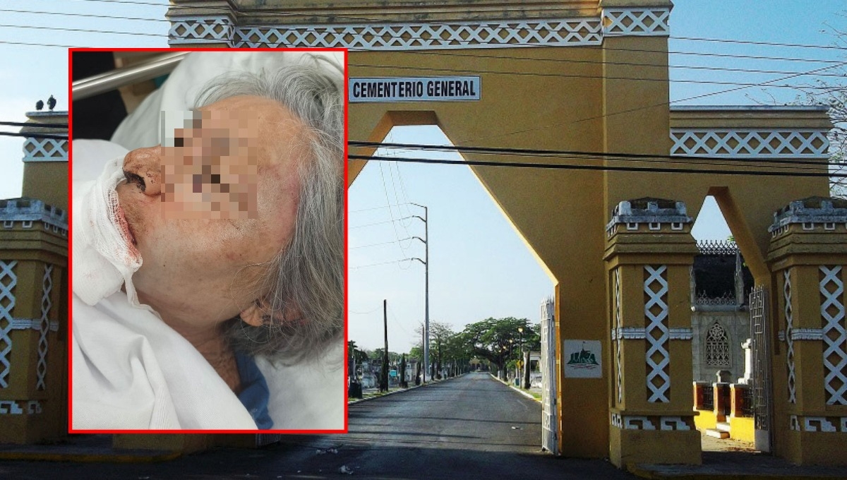 Golpean y asaltan a una abuelita en el Cementerio General de Mérida