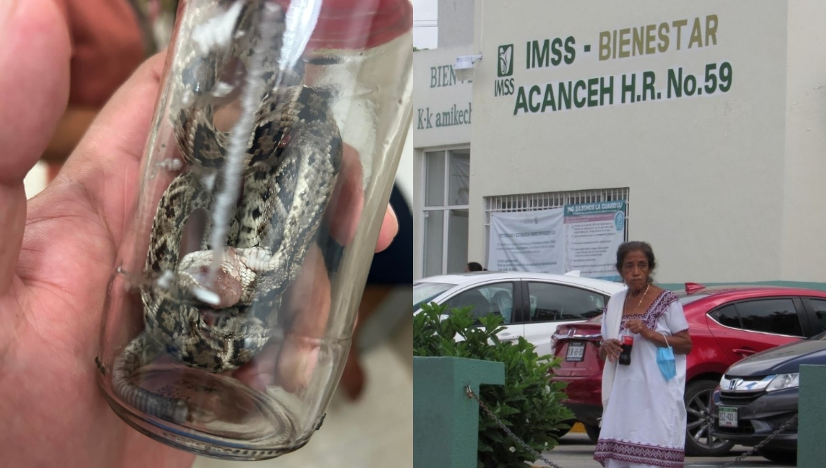 Serpiente de cascabel muerde a un niño de 9 años en Acanceh, Yucatán
