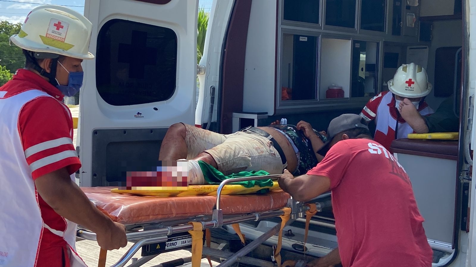 Conductor le destroza la pierna a una mujer en la carretera Escárcega-Villahermosa