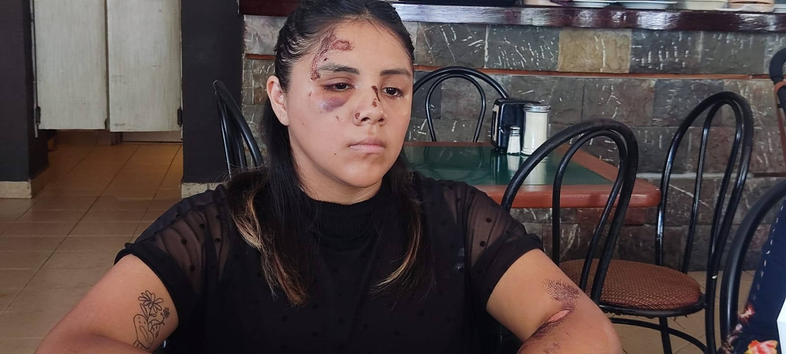 Buscan a conductor responsable de atropellar y dejar herida a una joven en Playa del Carmen