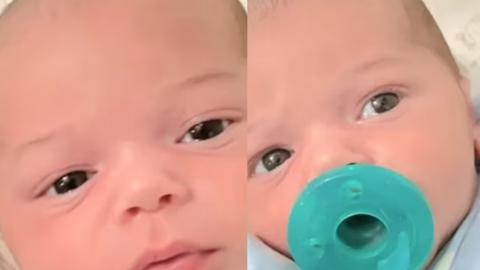 Ojos de un bebé de seis meses de edad cambiaron de cafés a azules