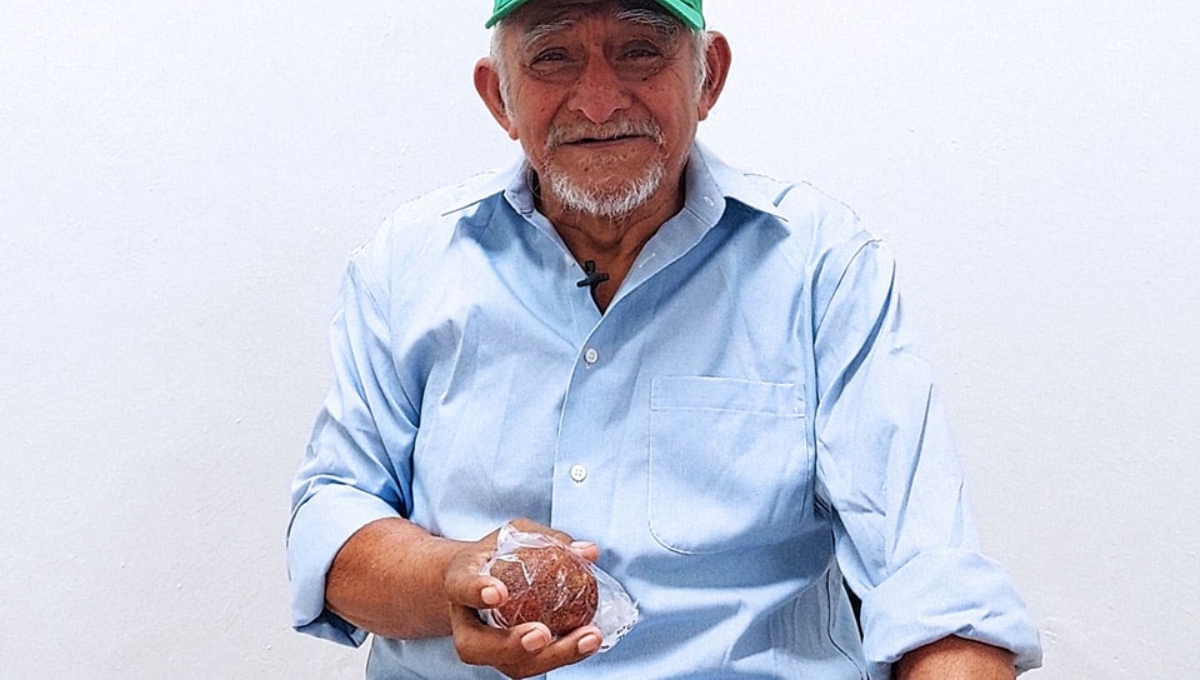 Extraen 'piedra gigante' de la vejiga de un abuelito en el IMSS de Izamal, Yucatán