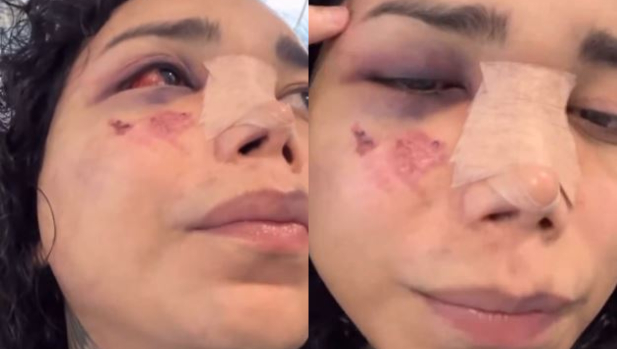 Paolita Suárez muestra su avance en el hospital tras ser golpeada por su prometido: VIDEO