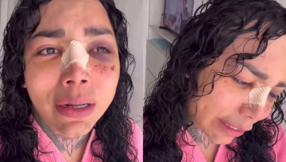Paola Suárez rompe en llanto tras presentar mejoría en sus heridas: VIDEO