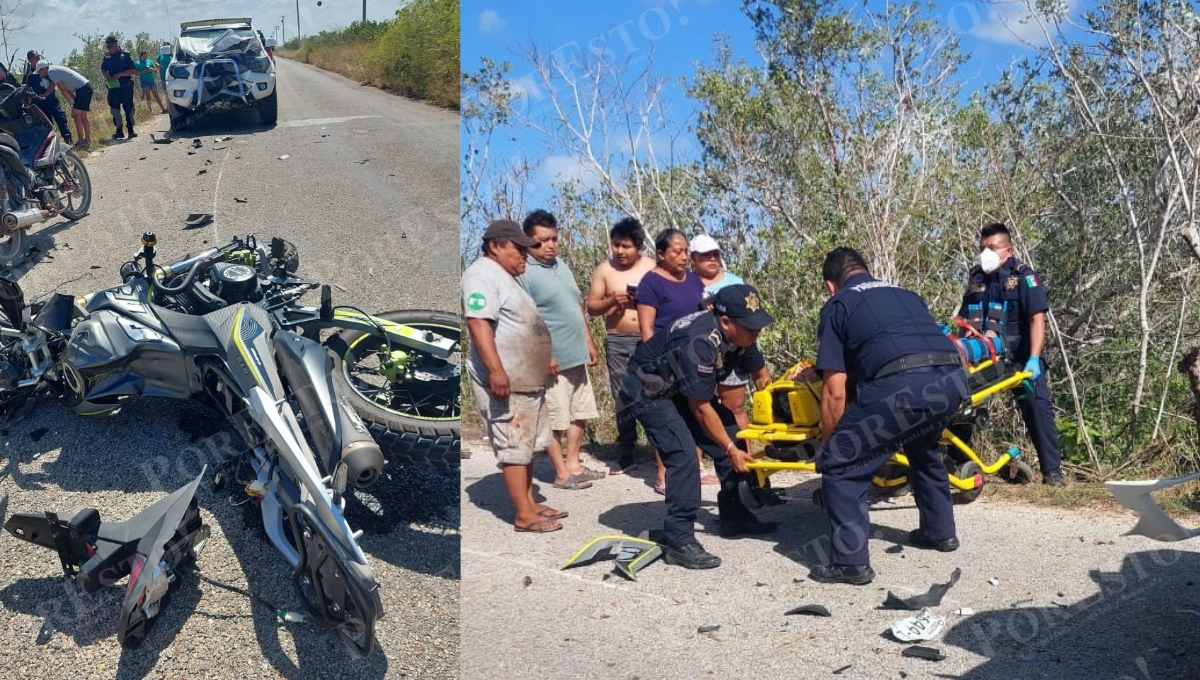 Accidentes Yucatán: Motociclista choca contra una camioneta y se fractura las piernas
