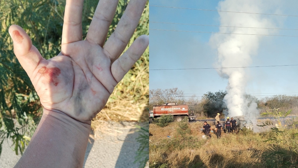 Conductor narra el rescate de dos personas en el accidente que dejó dos calcinadas en la vía Progreso-Mérida